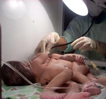 Posisi Bayi Dempet di Perut dengan Usus Terburai
